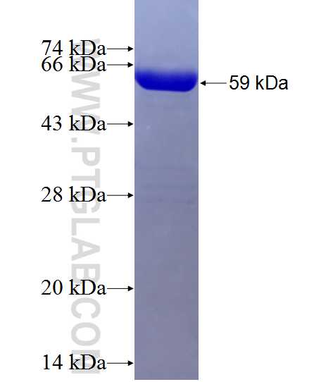 ACTN4 fusion protein Ag13546 SDS-PAGE