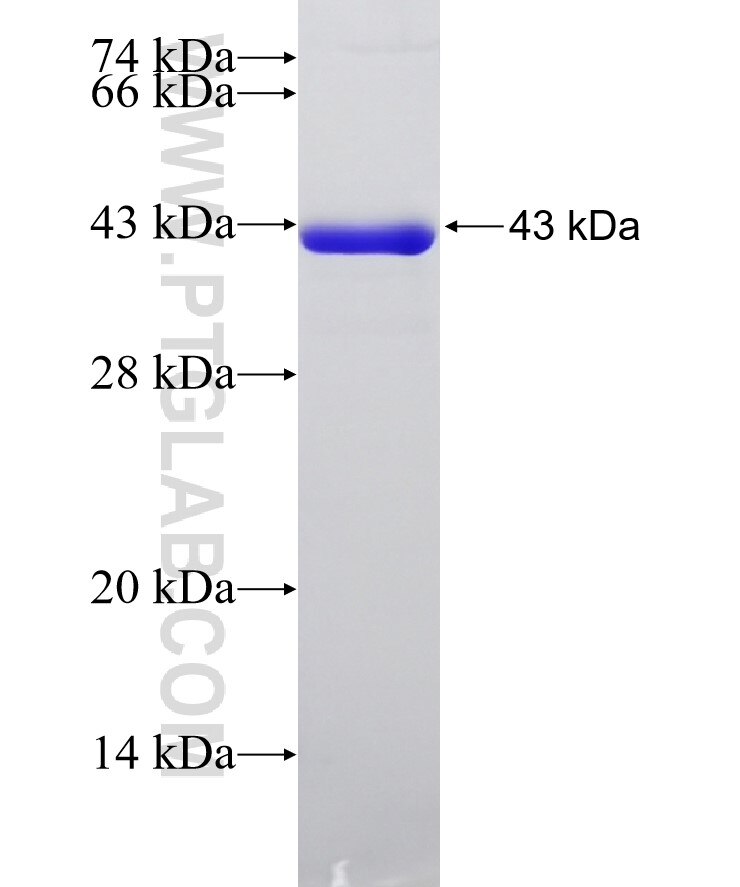 ACTN4 fusion protein Ag13549 SDS-PAGE