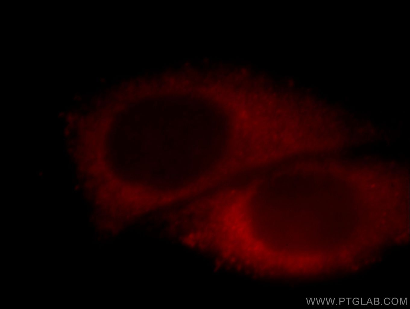 Immunofluorescence (IF) / fluorescent staining of HepG2 cells using ACTR10 Polyclonal antibody (20101-1-AP)