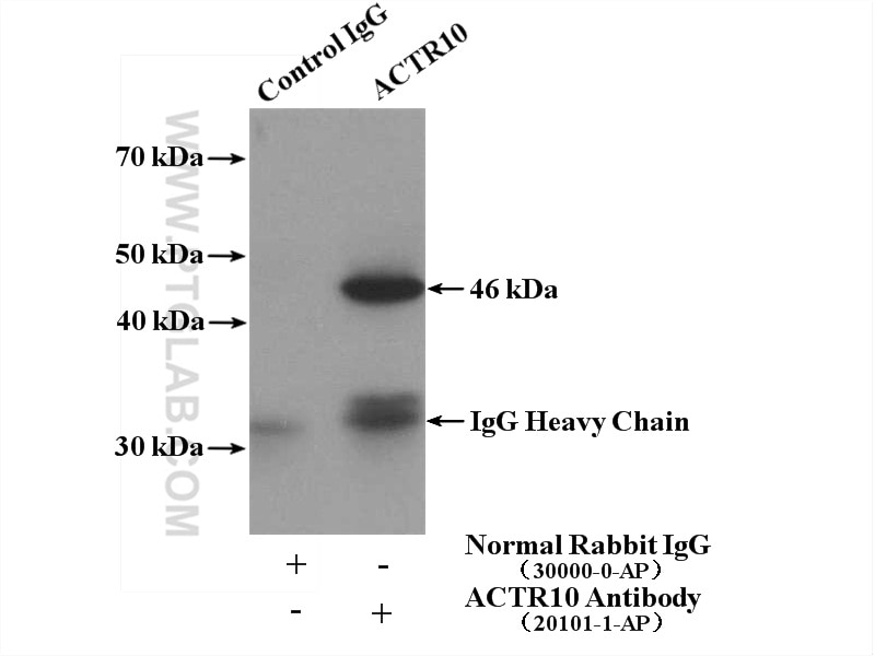 Immunoprecipitation (IP) experiment of mouse brain tissue using ACTR10 Polyclonal antibody (20101-1-AP)