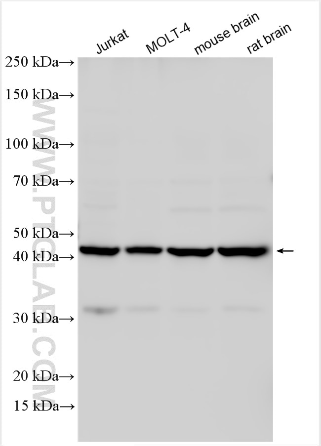 Western Blot (WB) analysis of various lysates using ACTR1A Polyclonal antibody (10357-1-AP)