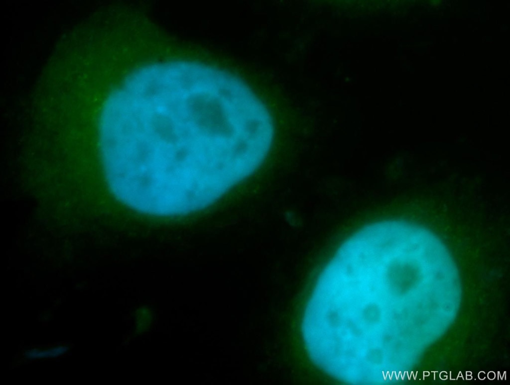Immunofluorescence (IF) / fluorescent staining of MCF-7 cells using ACTR1B Polyclonal antibody (11023-1-AP)
