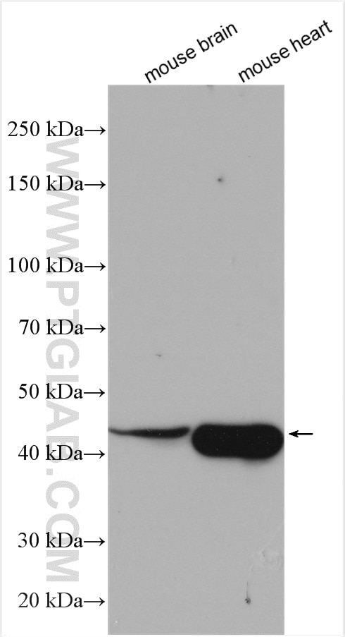 Western Blot (WB) analysis of various lysates using ACTR1B Polyclonal antibody (11023-1-AP)