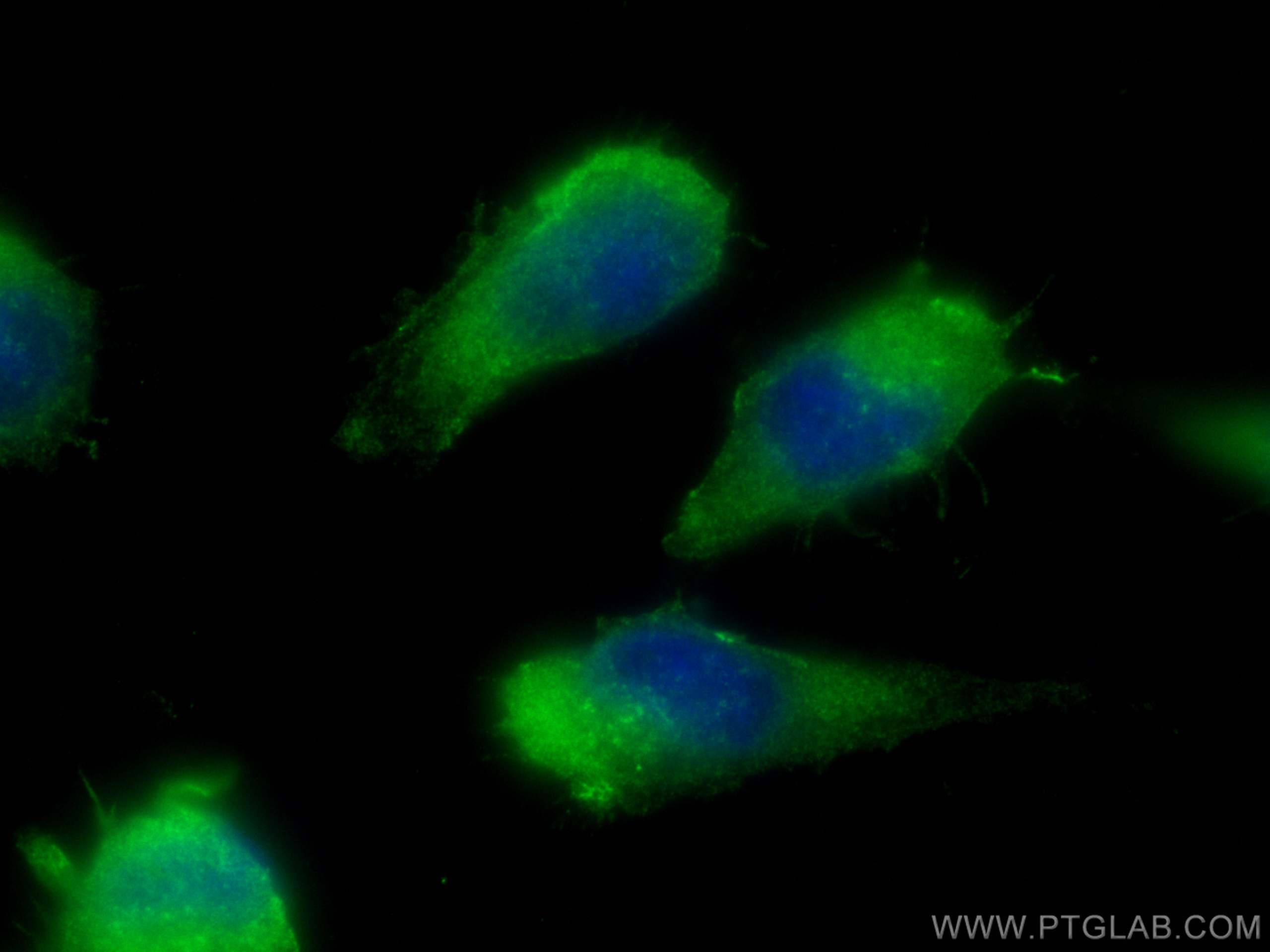 Immunofluorescence (IF) / fluorescent staining of U-251 cells using ARP2 Polyclonal antibody (10922-1-AP)