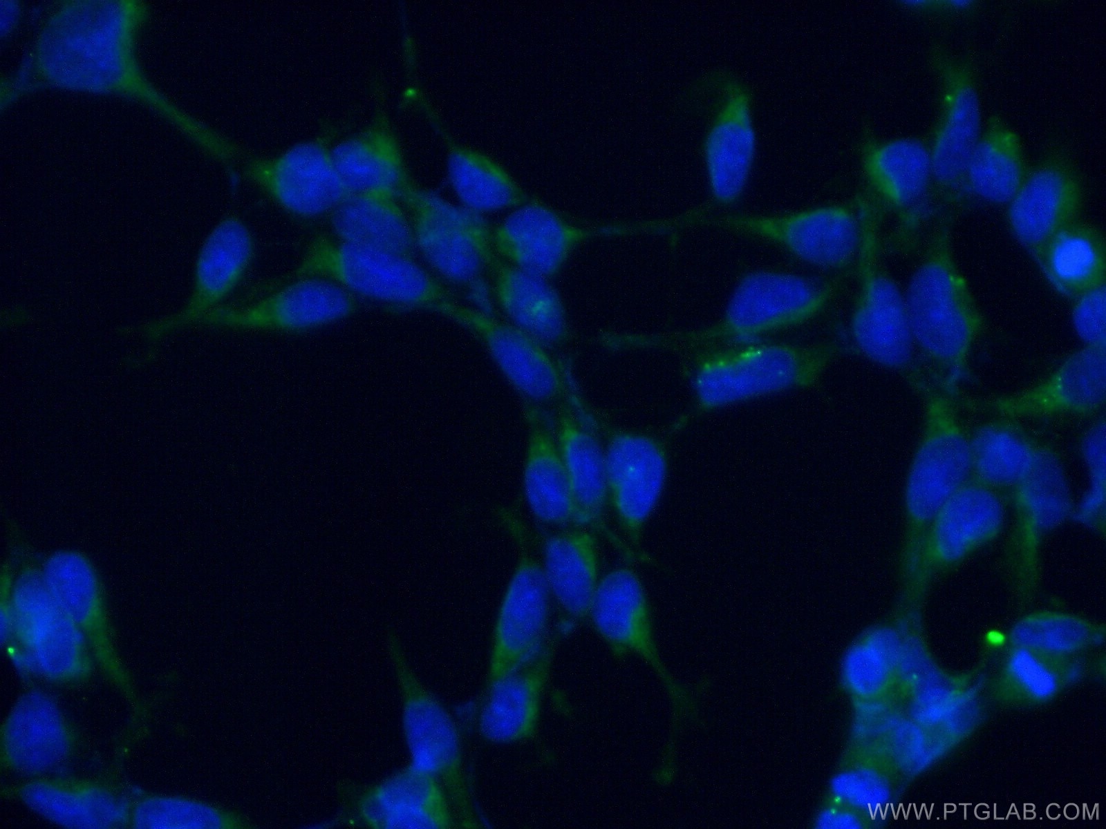 Immunofluorescence (IF) / fluorescent staining of HEK-293 cells using ARP2 Polyclonal antibody (10922-1-AP)