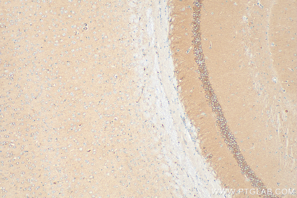 Immunohistochemistry (IHC) staining of mouse brain tissue using ARP2 Polyclonal antibody (10922-1-AP)