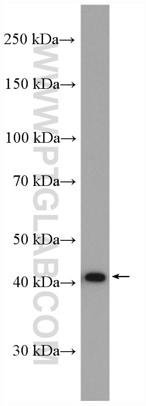 Western Blot (WB) analysis of mouse kidney tissue using ARP2 Polyclonal antibody (10922-1-AP)