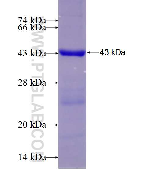 ACTR2 fusion protein Ag28557 SDS-PAGE