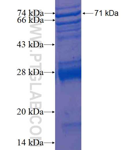 ACTR2 fusion protein Ag1359 SDS-PAGE