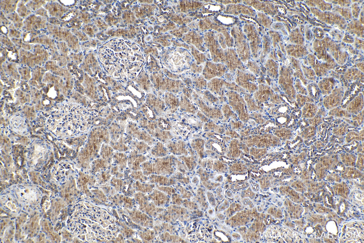 Immunohistochemistry (IHC) staining of human kidney tissue using ARP3/ARP3B Polyclonal antibody (13822-1-AP)