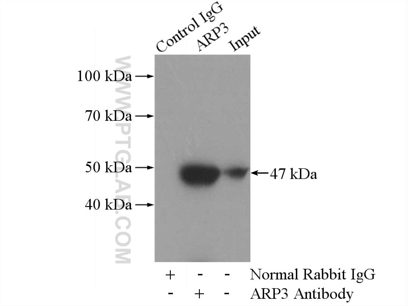Immunoprecipitation (IP) experiment of mouse spleen tissue using ARP3/ARP3B Polyclonal antibody (13822-1-AP)