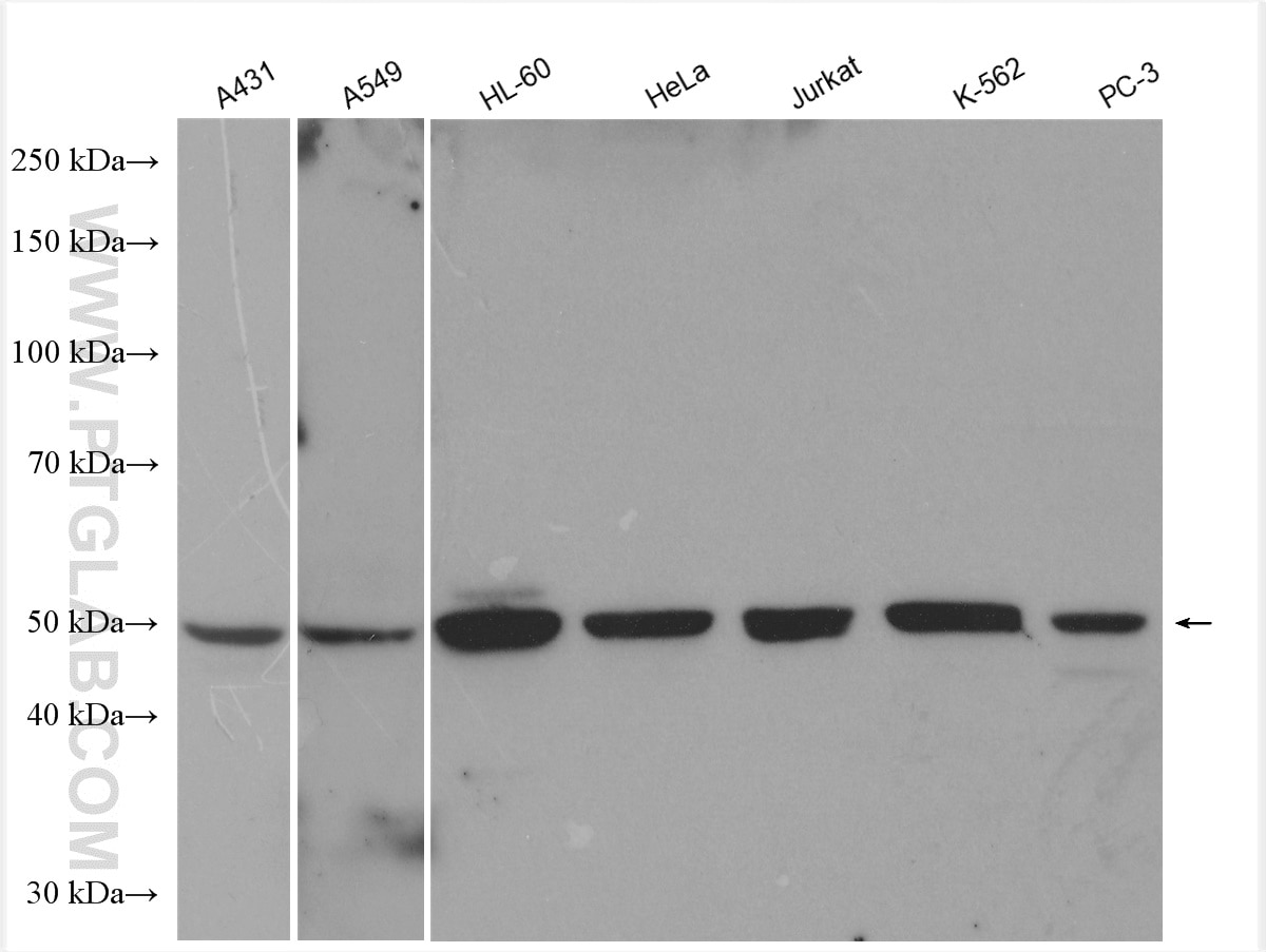 Western Blot (WB) analysis of various lysates using ARP3/ARP3B Polyclonal antibody (13822-1-AP)