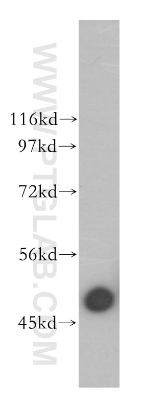 WB analysis of mouse spleen using 13822-1-AP