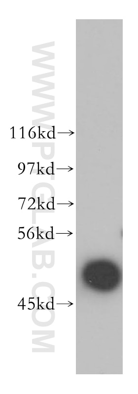 Western Blot (WB) analysis of human liver tissue using ARP3/ARP3B Polyclonal antibody (13822-1-AP)