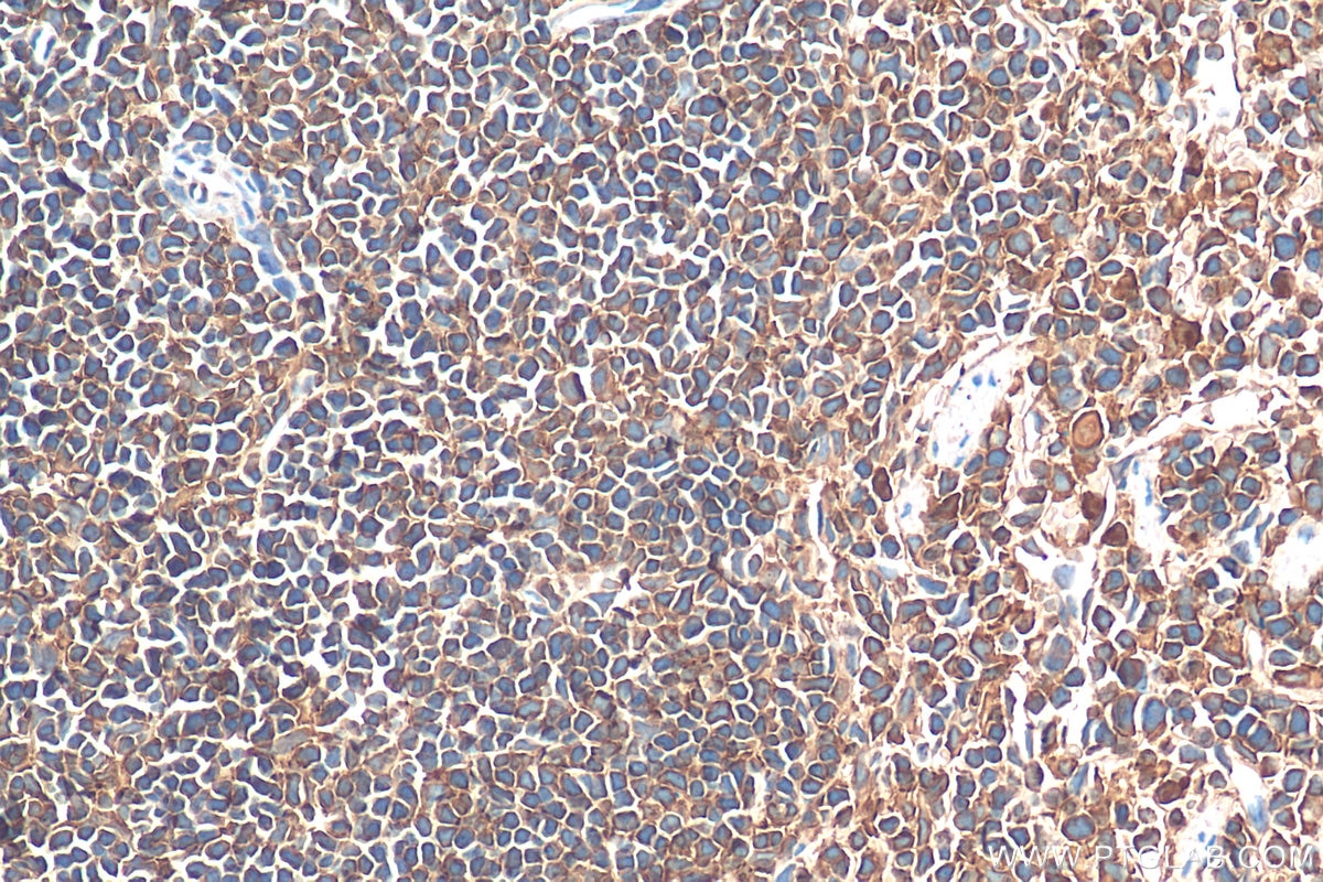 Immunohistochemistry (IHC) staining of mouse spleen tissue using ARP3/ARP3B Monoclonal antibody (68439-1-Ig)
