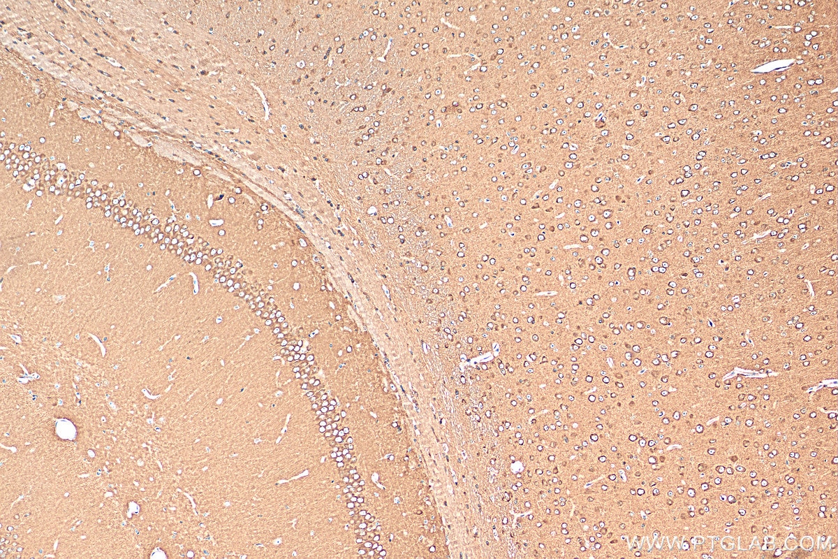 Immunohistochemistry (IHC) staining of mouse brain tissue using ARP3/ARP3B Monoclonal antibody (68439-1-Ig)