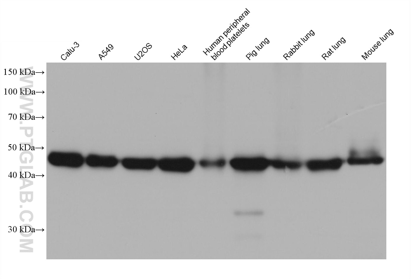 Western Blot (WB) analysis of various lysates using ARP3/ARP3B Monoclonal antibody (68439-1-Ig)