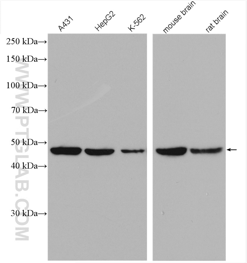 Western Blot (WB) analysis of various lysates using ACTR3B Polyclonal antibody (17022-1-AP)
