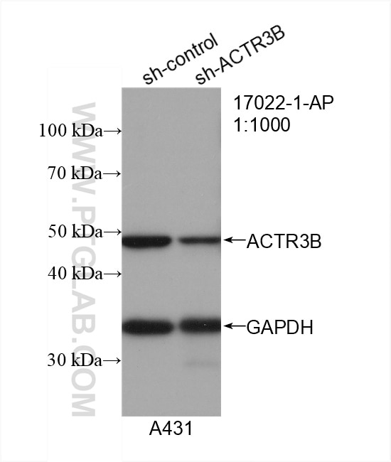 Western Blot (WB) analysis of A431 cells using ACTR3B Polyclonal antibody (17022-1-AP)