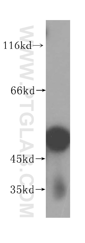 Western Blot (WB) analysis of mouse pancreas tissue using ACTR3B Polyclonal antibody (17022-1-AP)