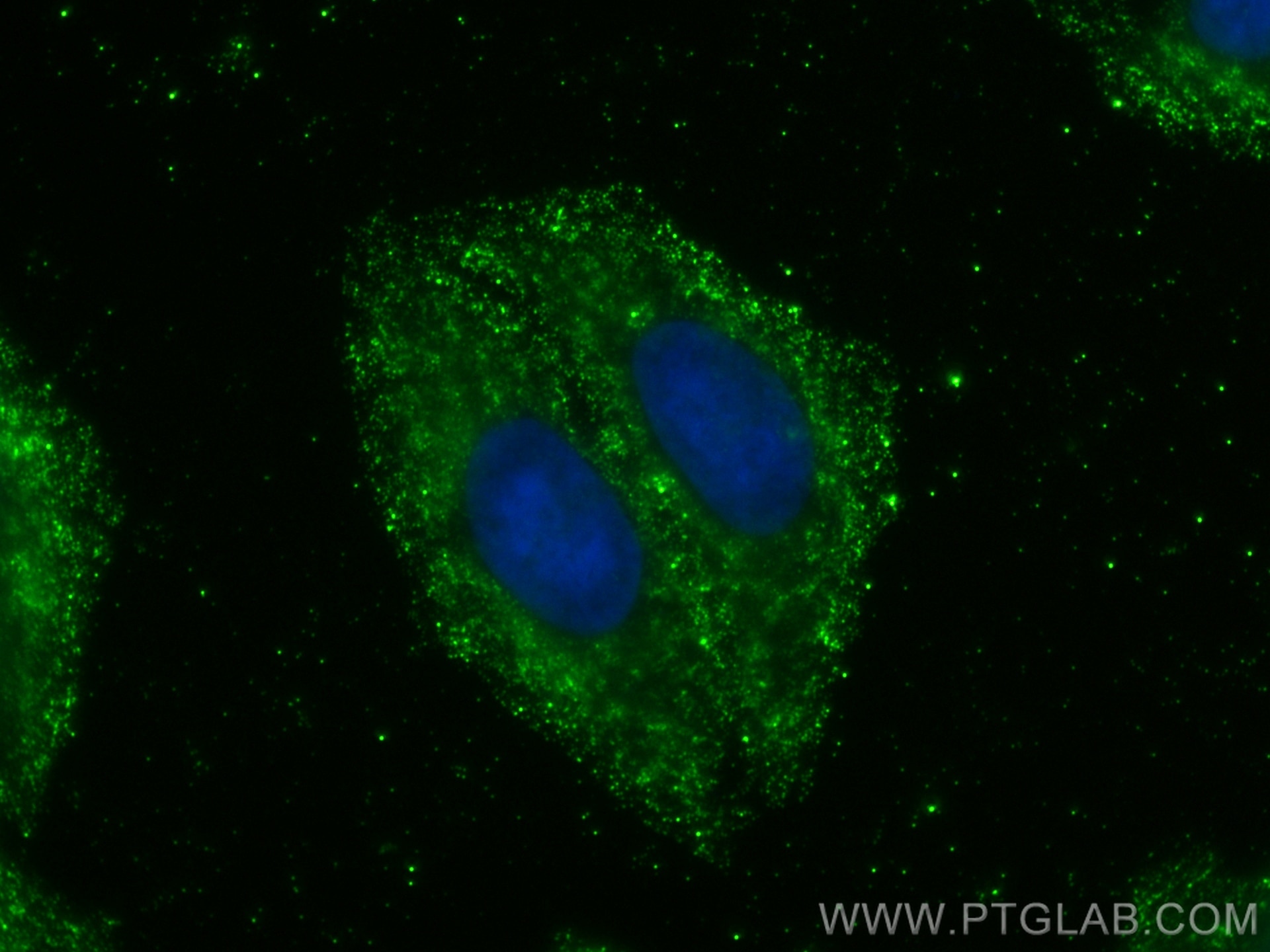 Immunofluorescence (IF) / fluorescent staining of HepG2 cells using ACTR3B Monoclonal antibody (68037-1-Ig)