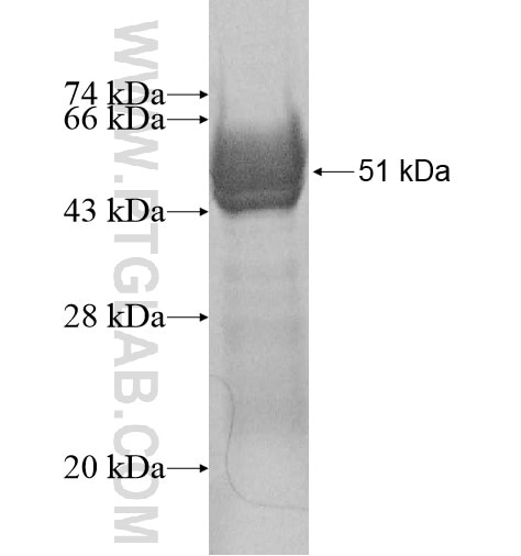 ACTR3B fusion protein Ag10218 SDS-PAGE