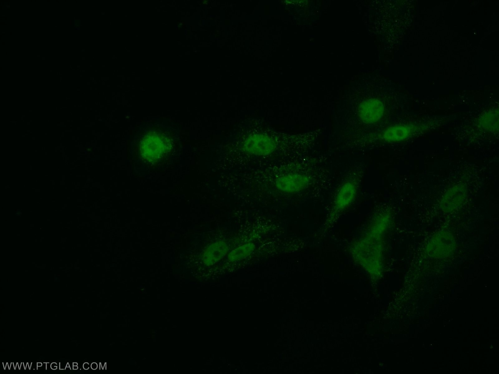 Immunofluorescence (IF) / fluorescent staining of A549 cells using Arp5/ACTR5 Polyclonal antibody (21505-1-AP)