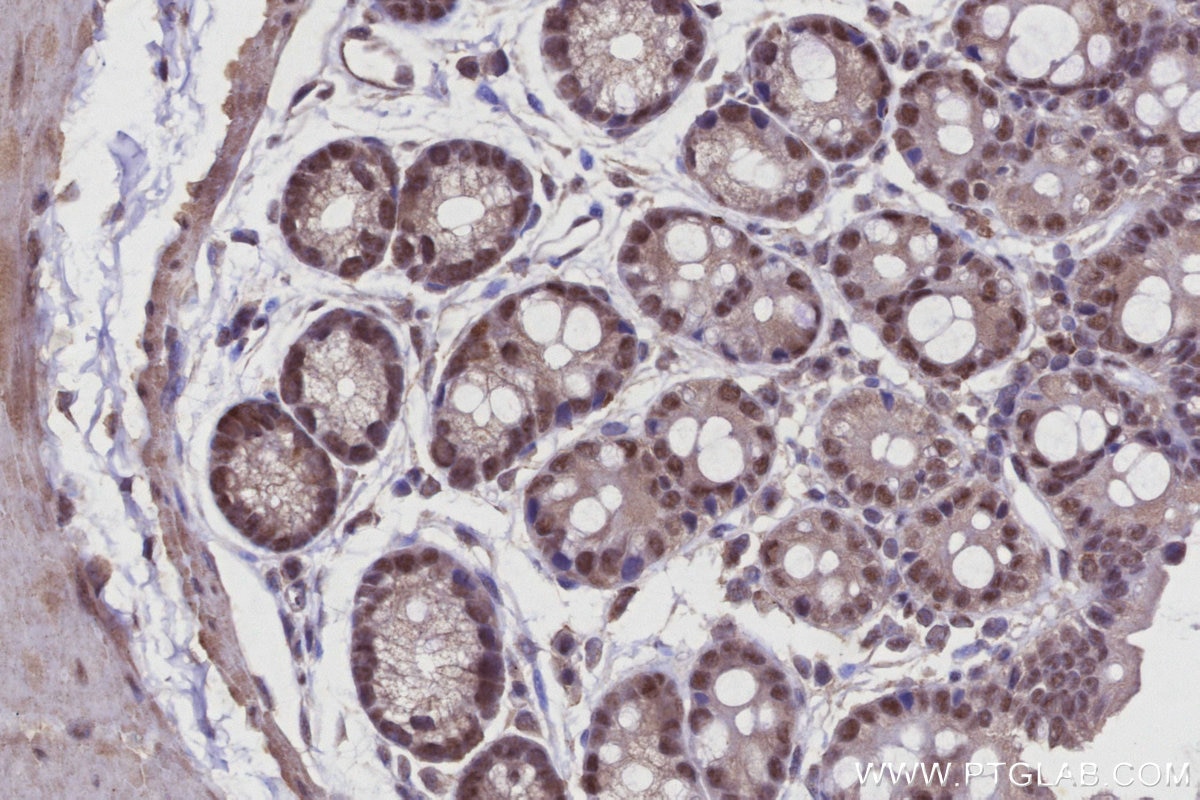 IHC staining of mouse colon using 21505-1-AP Immunohistochemistry (IHC) staining of mouse colon tissue using Arp5/ACTR5 Polyclonal antibody (21505-1-AP)