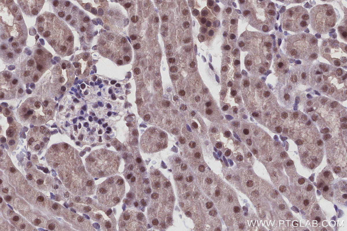 IHC staining of mouse kidney using 21505-1-AP Immunohistochemistry (IHC) staining of mouse kidney tissue using Arp5/ACTR5 Polyclonal antibody (21505-1-AP)