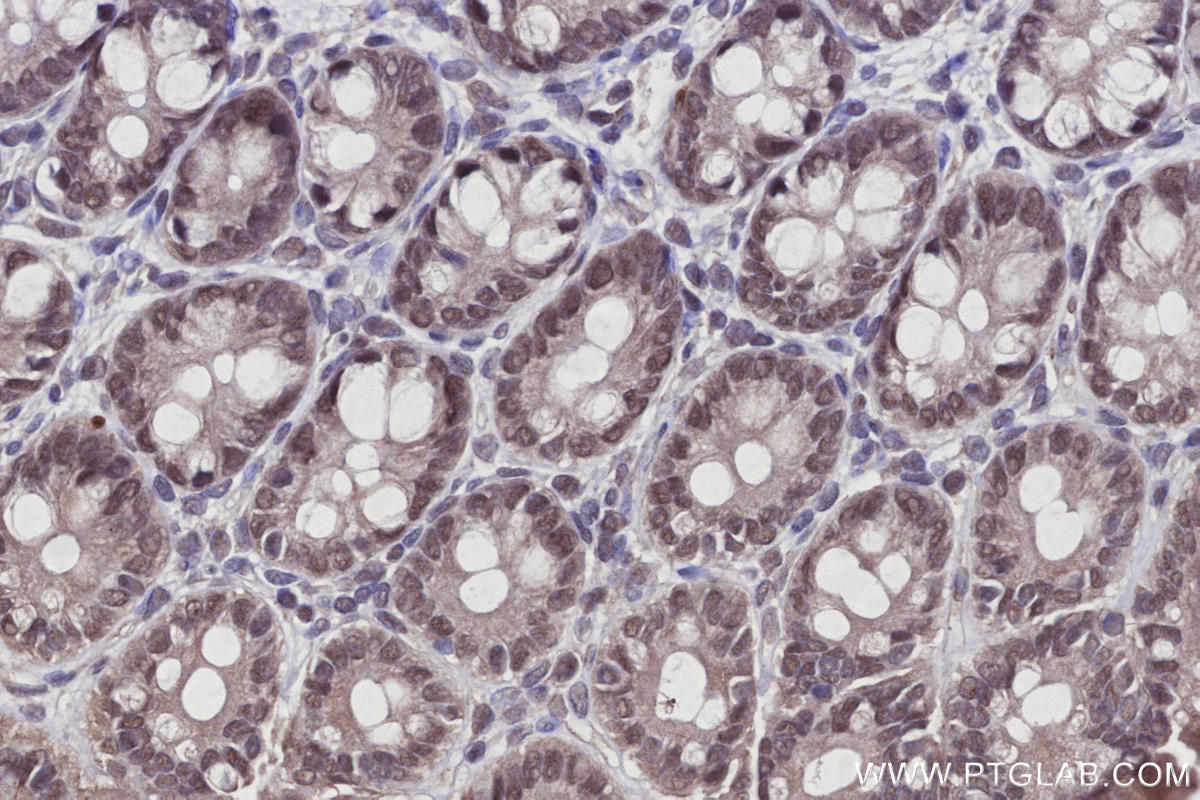 IHC staining of rat colon using 21505-1-AP Immunohistochemistry (IHC) staining of rat colon tissue using Arp5/ACTR5 Polyclonal antibody (21505-1-AP)