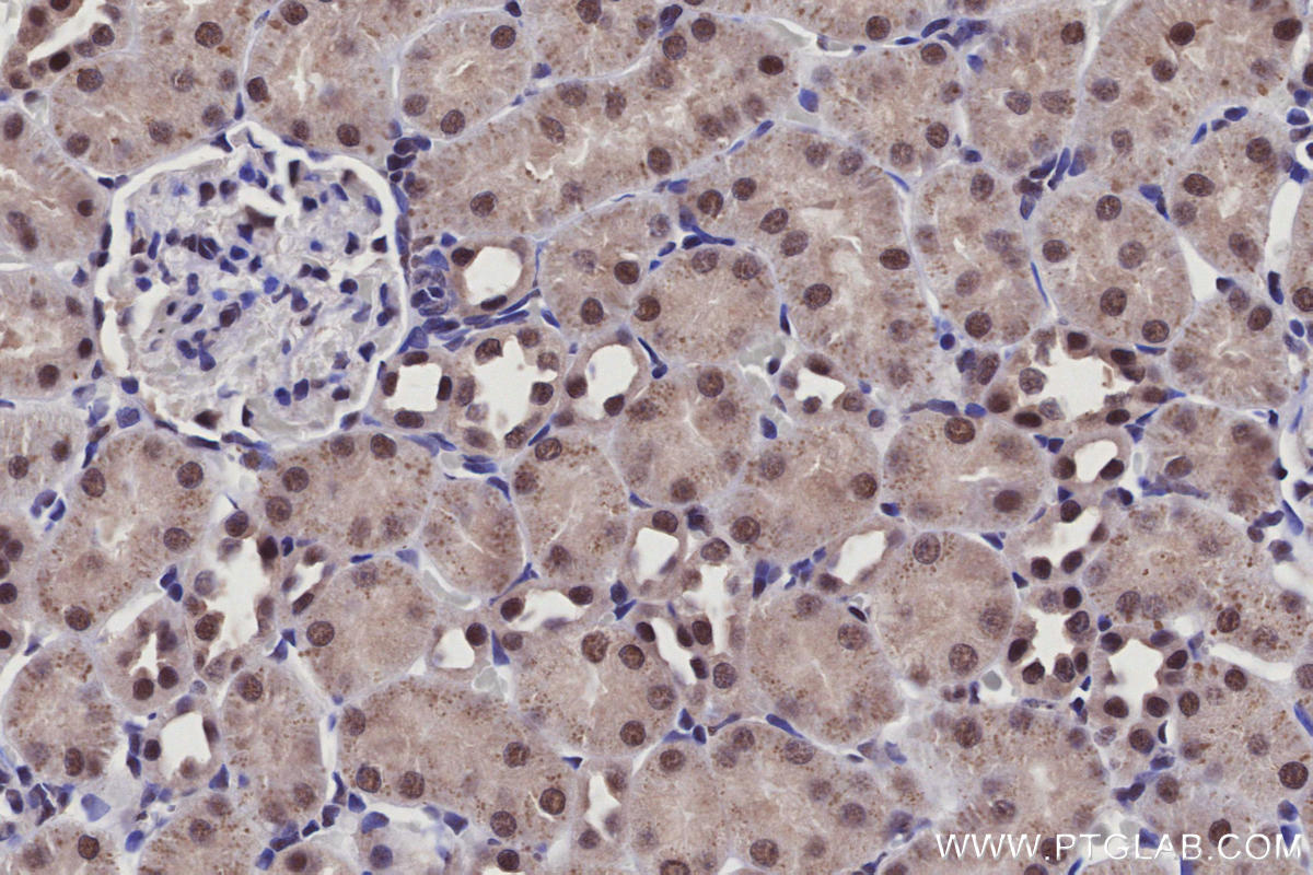 IHC staining of rat kidney using 21505-1-AP Immunohistochemistry (IHC) staining of rat kidney tissue using Arp5/ACTR5 Polyclonal antibody (21505-1-AP)