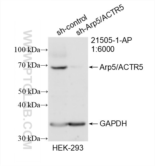 Western Blot (WB) analysis of HEK-293 cells using Arp5/ACTR5 Polyclonal antibody (21505-1-AP)