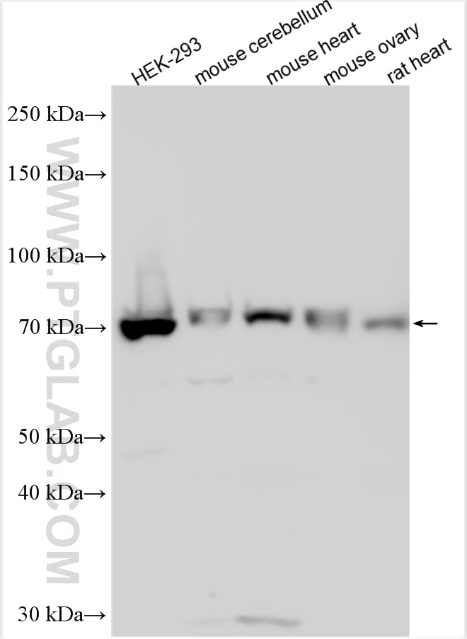 Western Blot (WB) analysis of various lysates using Arp5/ACTR5 Polyclonal antibody (21505-1-AP)