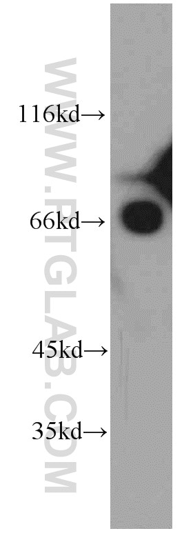 Western Blot (WB) analysis of HEK-293 cells using Arp5/ACTR5 Polyclonal antibody (21505-1-AP)