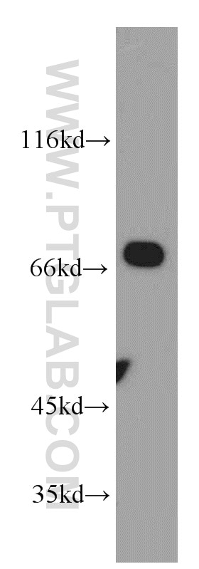 Western Blot (WB) analysis of mouse ovary tissue using Arp5/ACTR5 Polyclonal antibody (21505-1-AP)