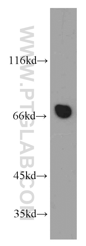 Western Blot (WB) analysis of mouse cerebellum tissue using Arp5/ACTR5 Polyclonal antibody (21505-1-AP)