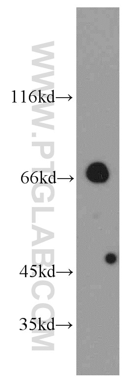 Western Blot (WB) analysis of mouse heart tissue using Arp5/ACTR5 Polyclonal antibody (21505-1-AP)