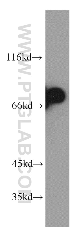 Western Blot (WB) analysis of human skeletal muscle tissue using Arp5/ACTR5 Polyclonal antibody (21505-1-AP)