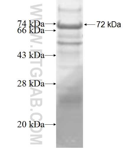 ACTR6 fusion protein Ag9268 SDS-PAGE