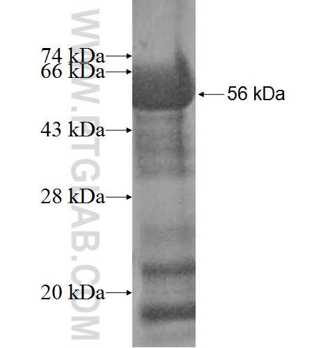 ACTR6 fusion protein Ag9578 SDS-PAGE