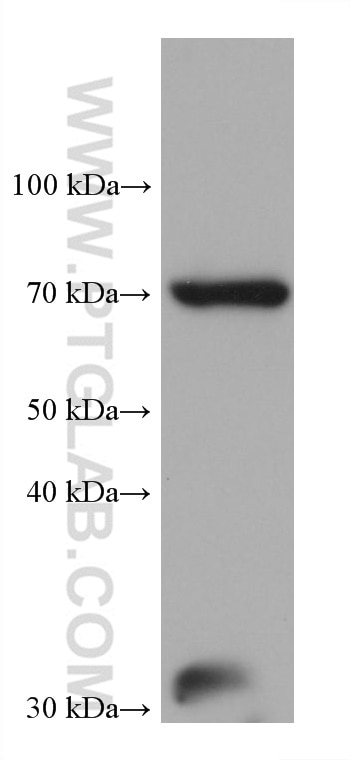 Western Blot (WB) analysis of LNCaP cells using ACTR8 Monoclonal antibody (68784-1-Ig)