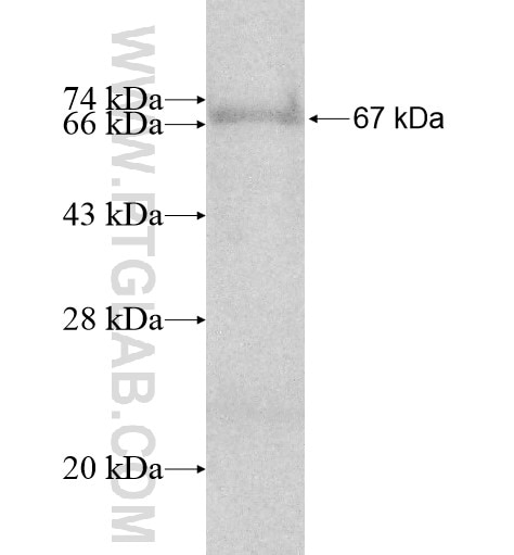 ACTR8 fusion protein Ag11367 SDS-PAGE