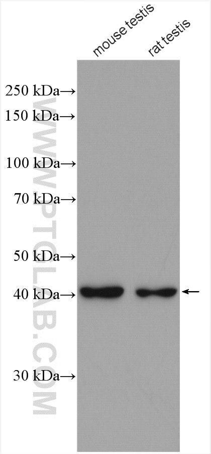Western Blot (WB) analysis of various lysates using ACTRT2 Polyclonal antibody (16992-1-AP)