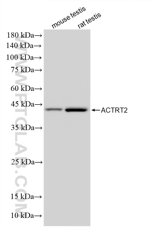 WB analysis using 86782-1-RR (same clone as 86782-1-PBS) Western Blot (WB) analysis of various lysates using ACTRT2 Recombinant monoclonal antibody (86782-1-RR)