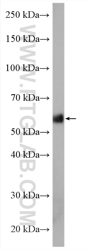 Western Blot (WB) analysis of mouse kidney tissue using ACVR1 Polyclonal antibody (11108-1-AP)