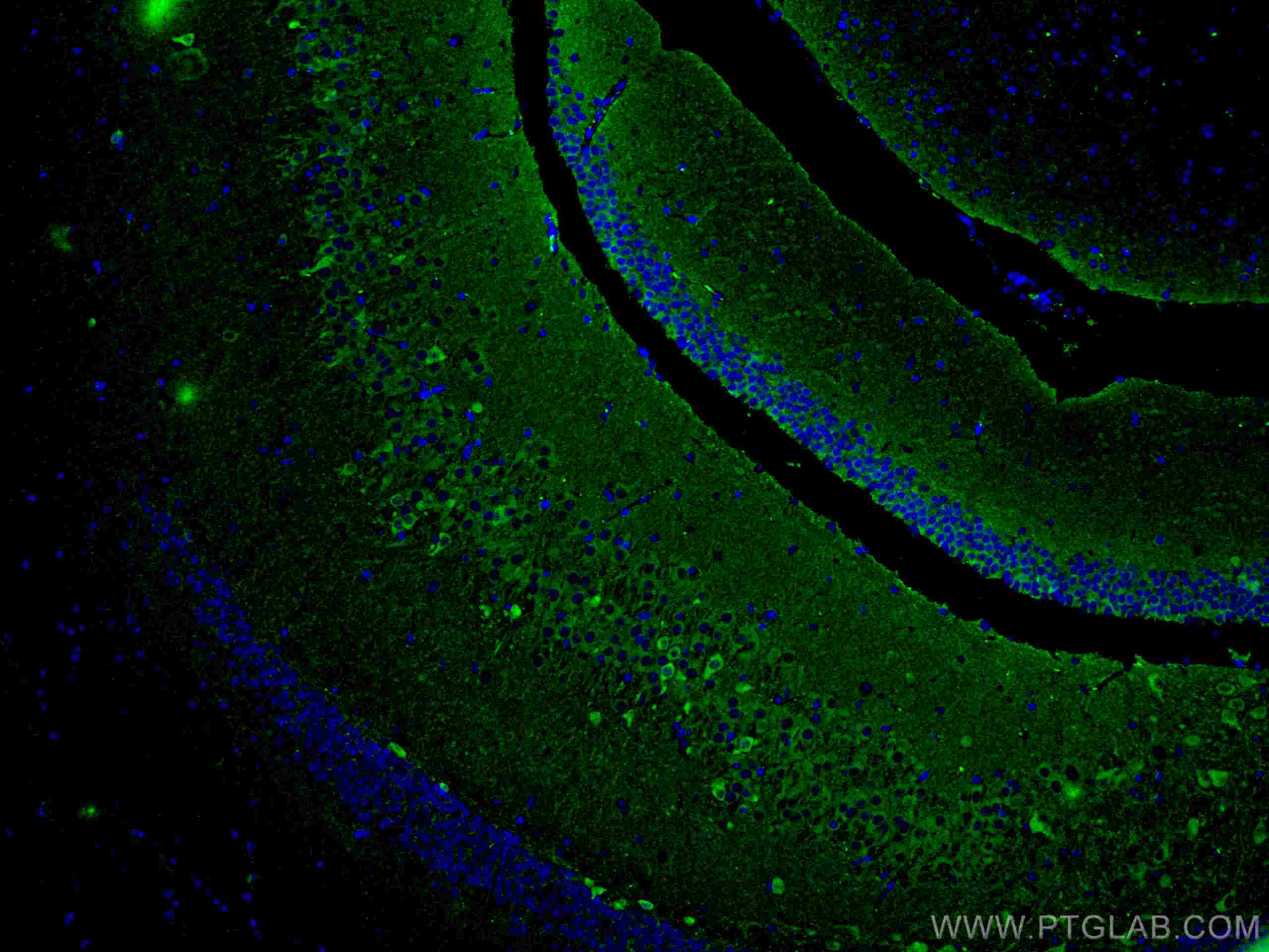 Immunofluorescence (IF) / fluorescent staining of mouse brain tissue using ACVR1 Monoclonal antibody (67417-1-Ig)