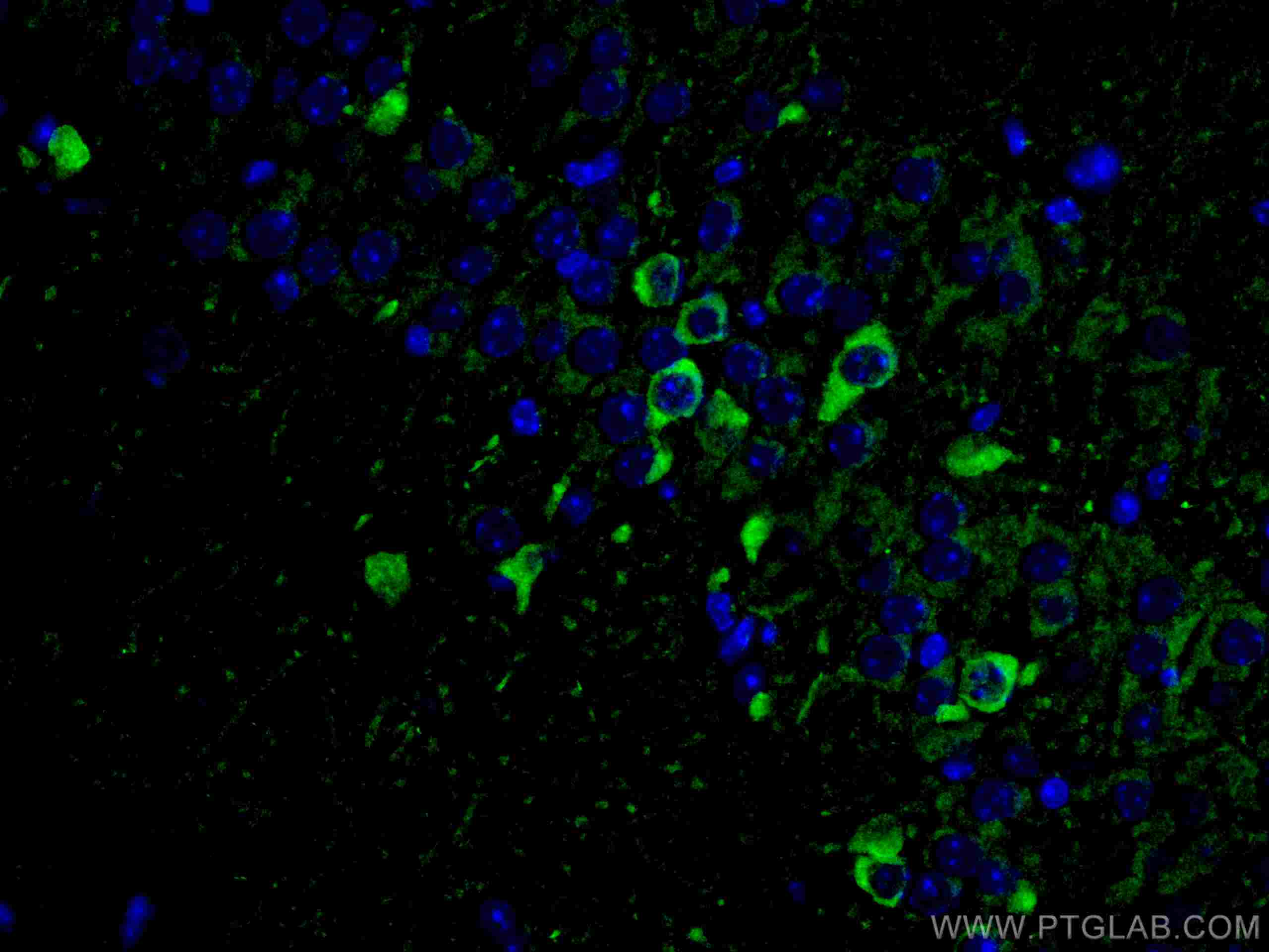 Immunofluorescence (IF) / fluorescent staining of mouse brain tissue using ACVR1 Monoclonal antibody (67417-1-Ig)