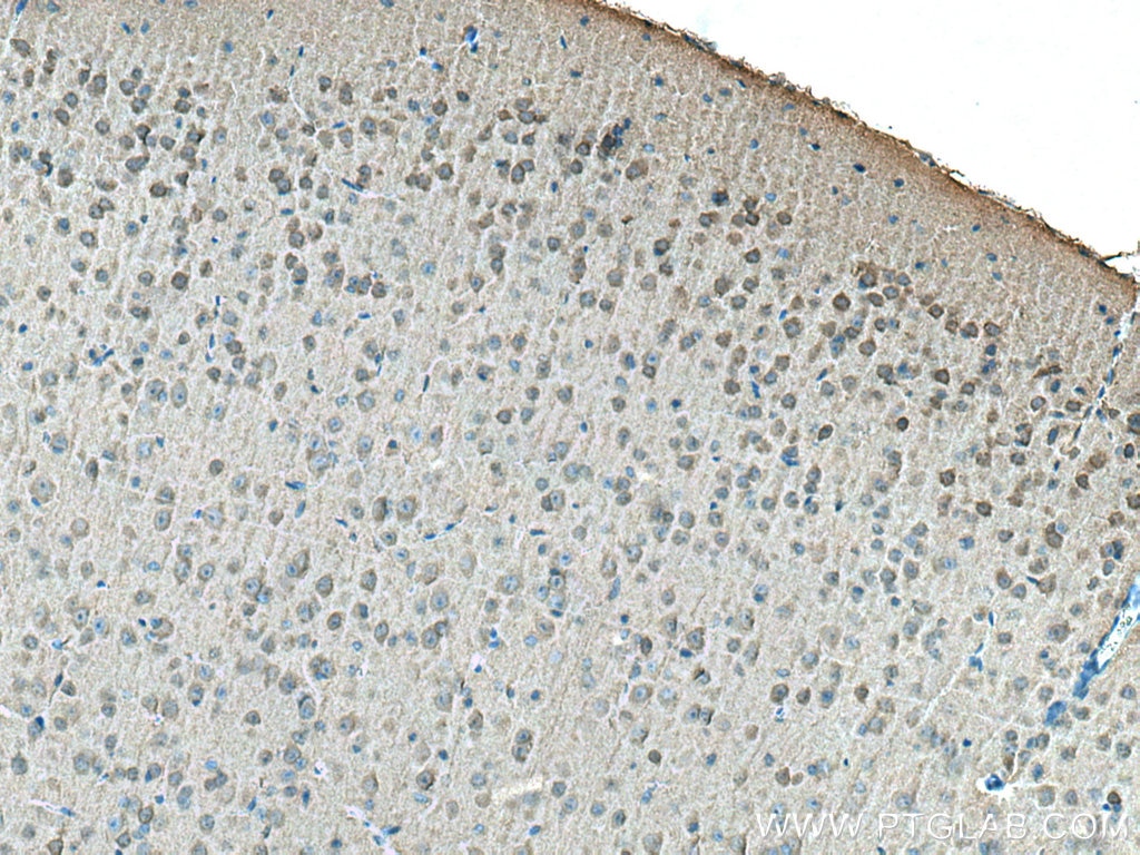Immunohistochemistry (IHC) staining of mouse brain tissue using ACVR1 Monoclonal antibody (67417-1-Ig)