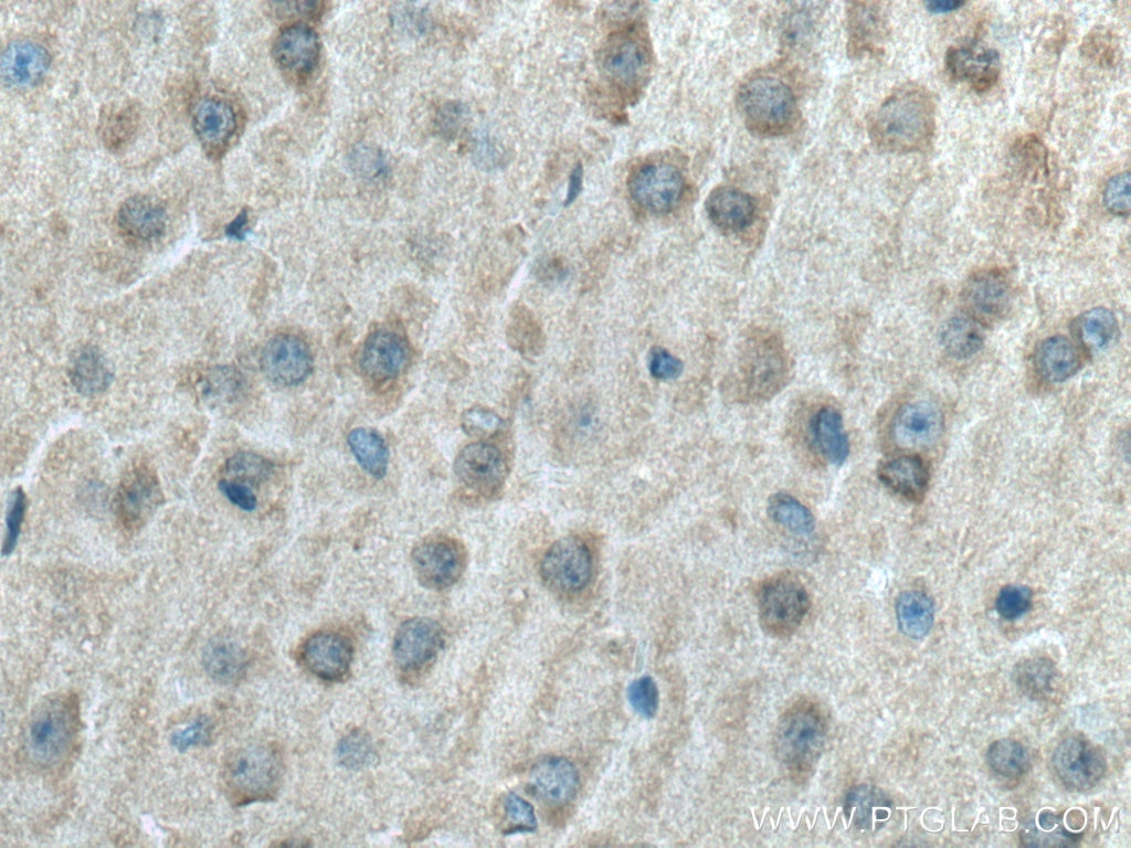 Immunohistochemistry (IHC) staining of mouse brain tissue using ACVR1 Monoclonal antibody (67417-1-Ig)