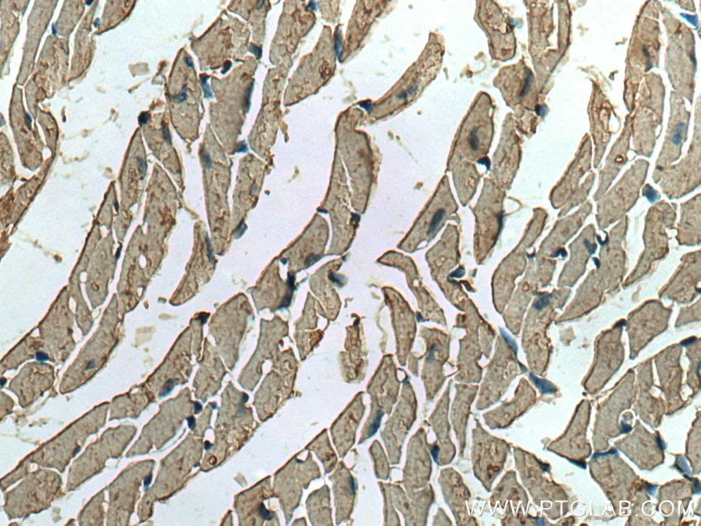 Immunohistochemistry (IHC) staining of mouse heart tissue using ACVR1 Monoclonal antibody (67417-1-Ig)